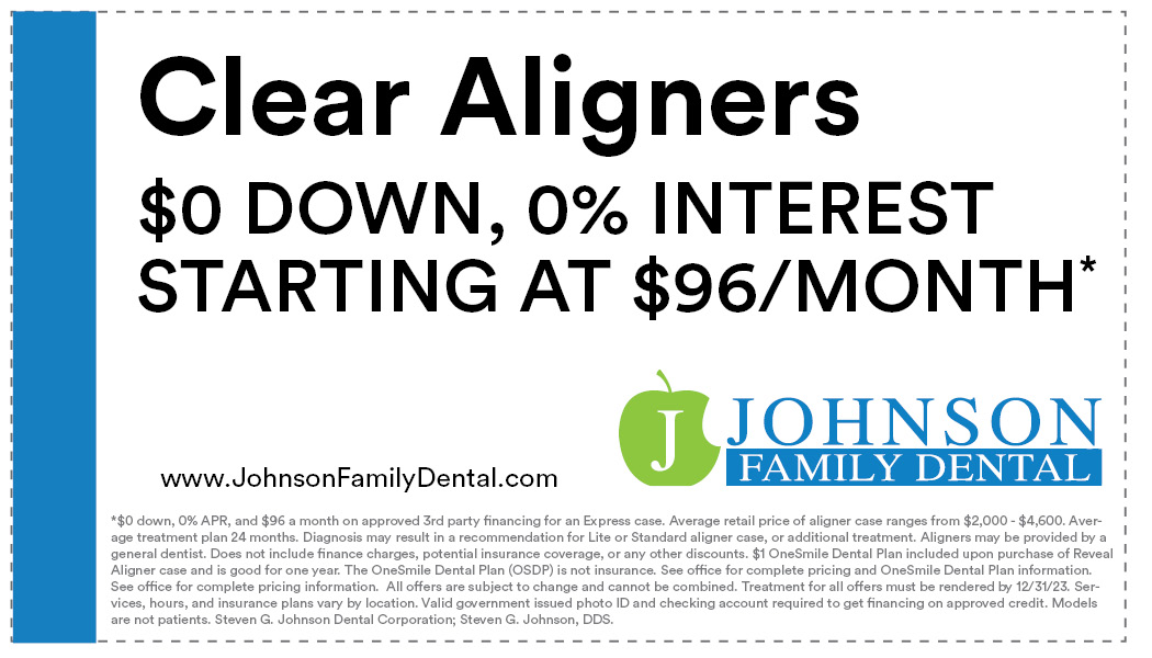 Clear Aligners - $0 Down, 0% Interest, starting at $96/month*