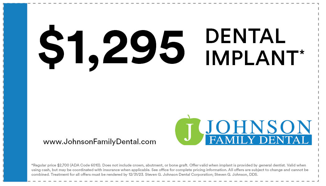 $1,295 Dental Implant Offer